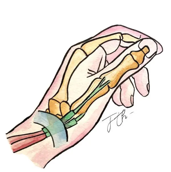 Tendinite de De Quervain, Pathologie fréquente de la main