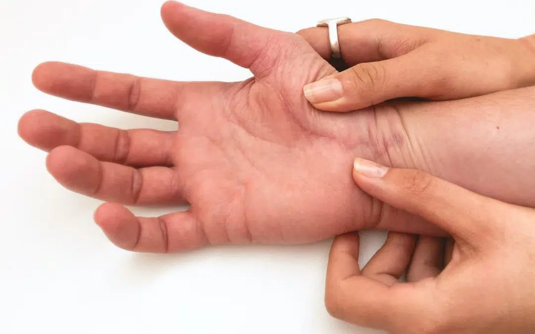 Comment soigner sa cicatrice ?