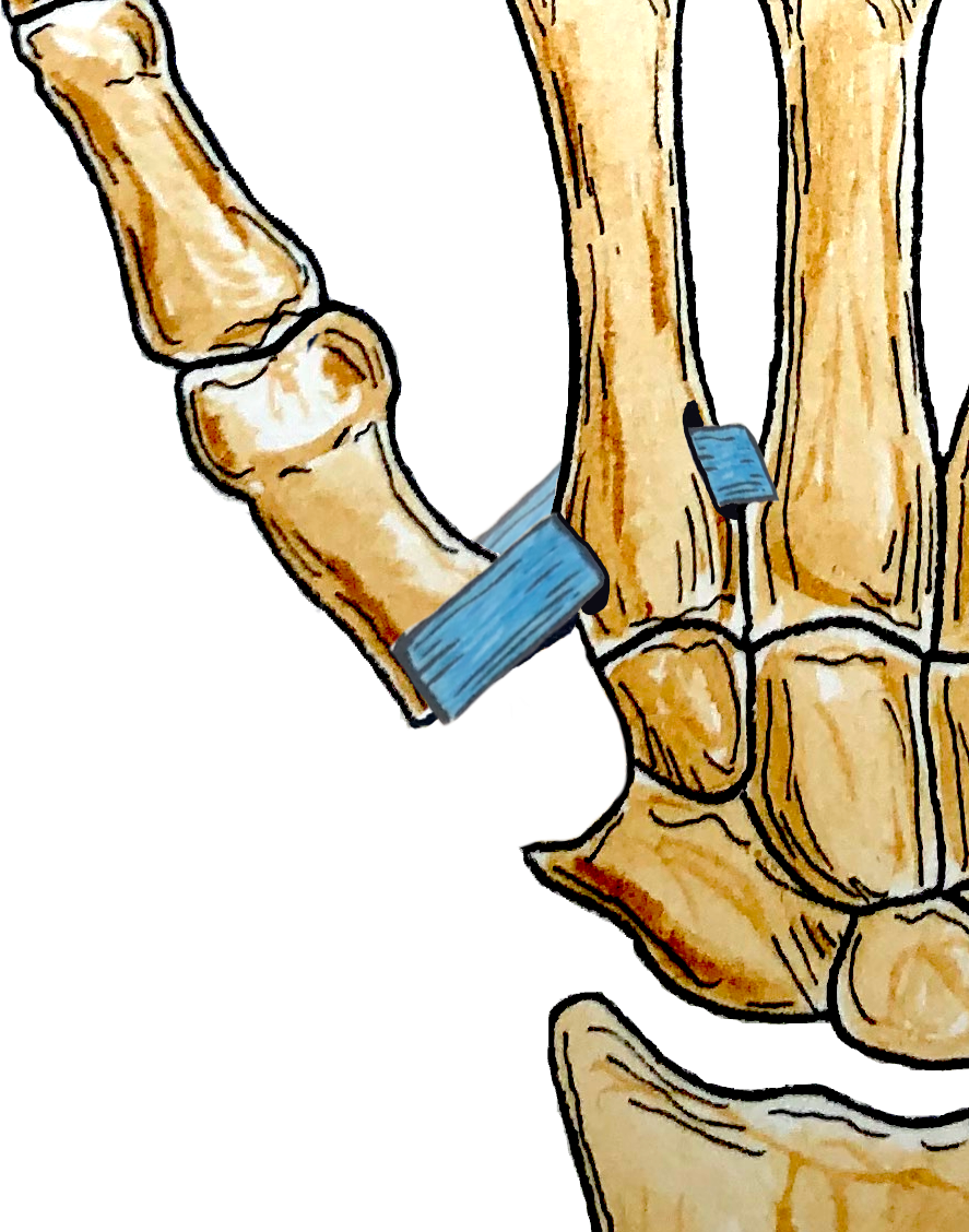 trapzeo metacarpienne